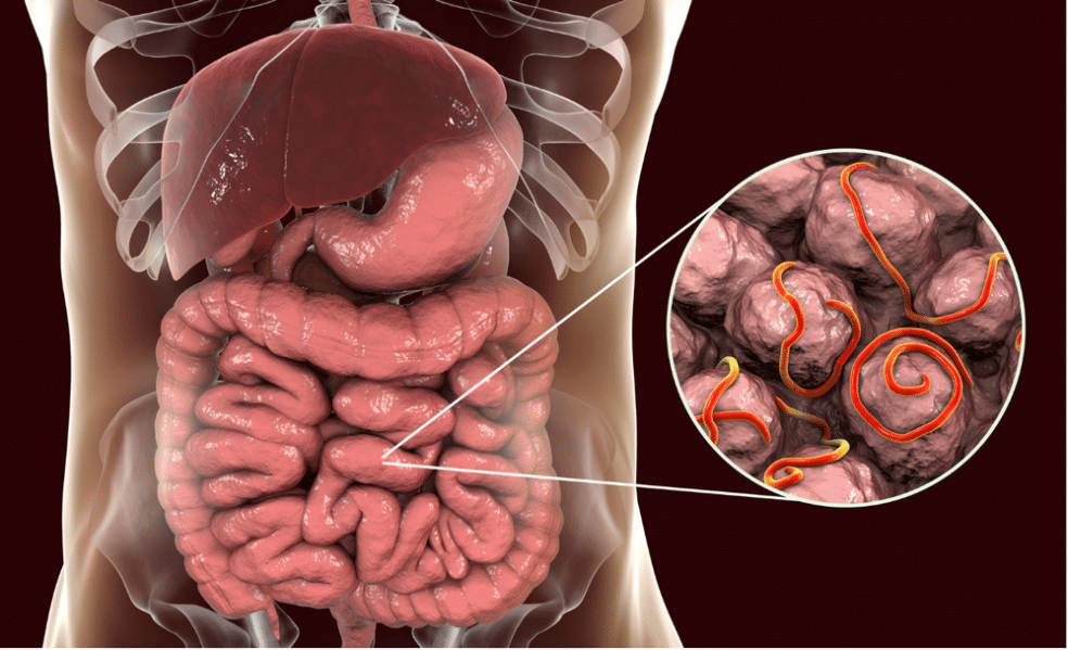Paraziti v telesu: kako pride do okužbe in kako se uspešno znebiti zajedavcev