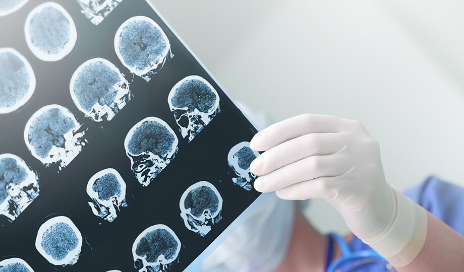 Najpomembnejše je hitro ukrepanje